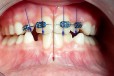 Matylda Lempel-Charęza Specjalistyczna Praktyka Dentystyczna