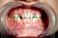 Matylda Lempel-Charęza Specjalistyczna Praktyka Dentystyczna