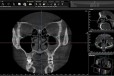Getwell Gabinet Tomografii Stomatologicznej